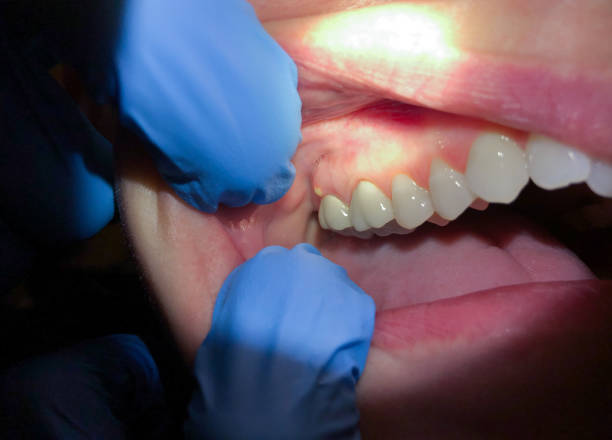 Best Pediatric Emergency Dentist in Yoe, PA